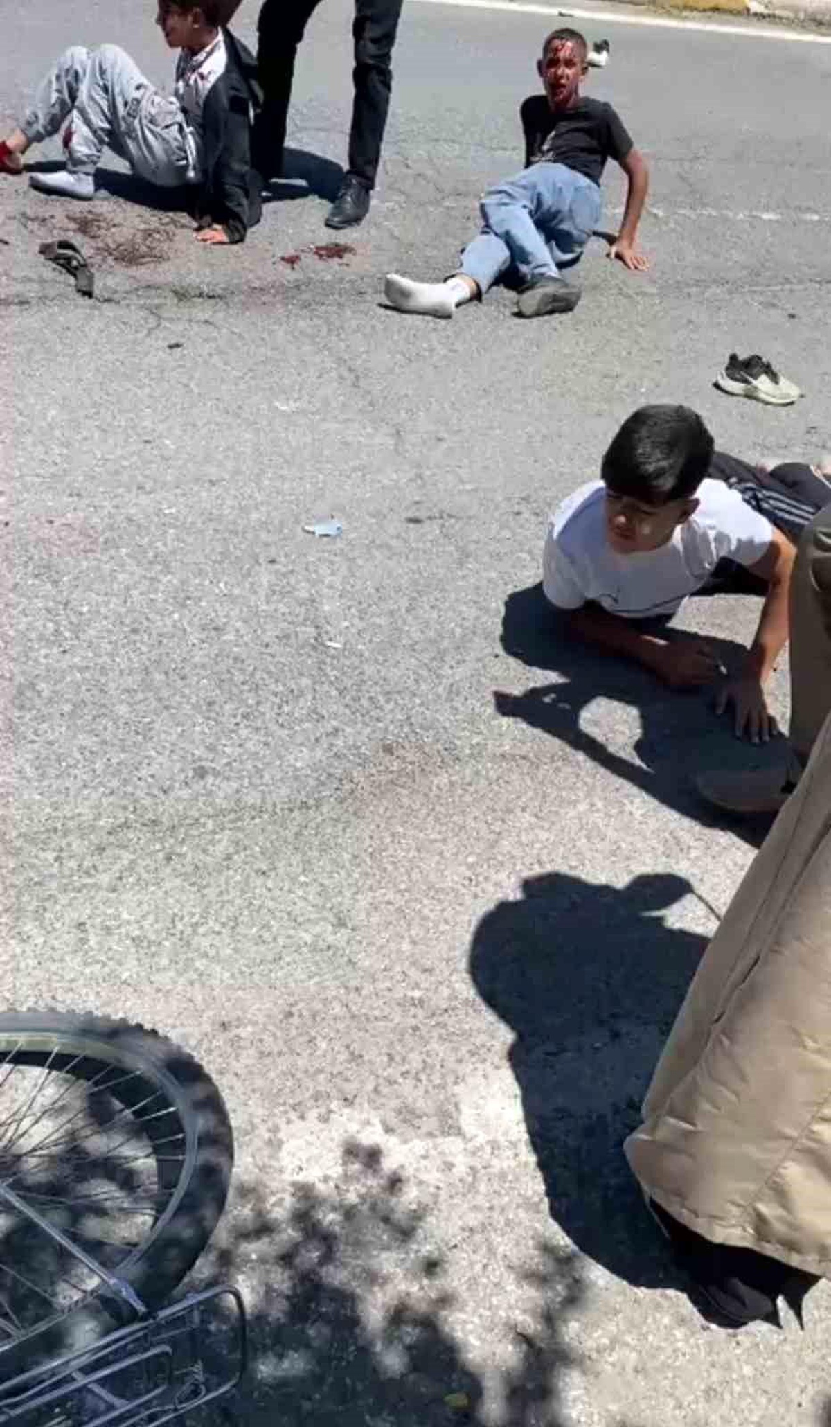[BELEDIYE · Ağrı · Patnos] Patnos'ta otomobilin çarptığı 3 bisikletli çocuk yaralandı