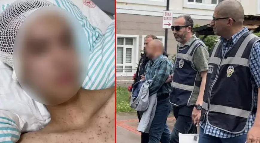 Çocuğu taciz etti, direnince kafasından vurdu! Korkunç olay 1 ay sonra ortaya çıktı: Sağ elinde silah bulunan mağdur solak çıktı