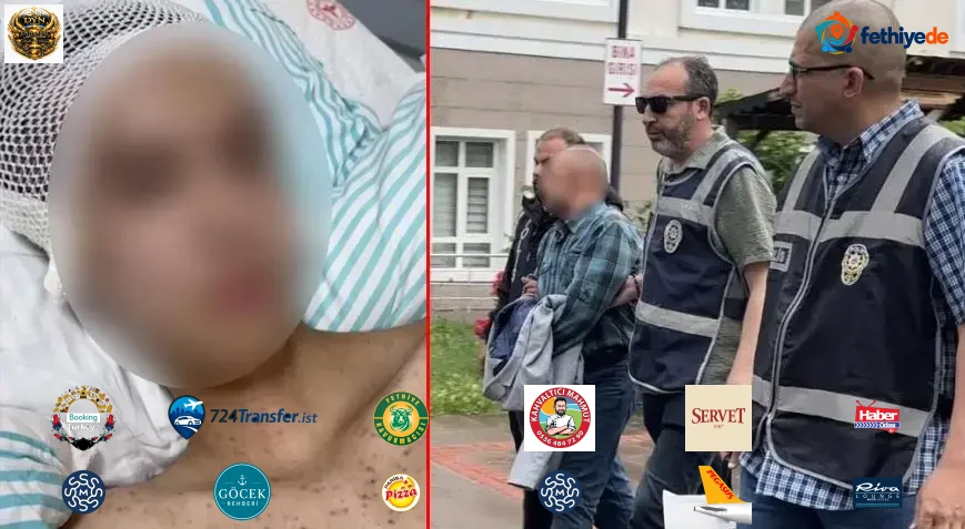 Çocuğu taciz etti, direnince kafasından vurdu! Korkunç olay 1 ay sonra ortaya çıktı: Sağ elinde silah bulunan mağdur solak çıktı