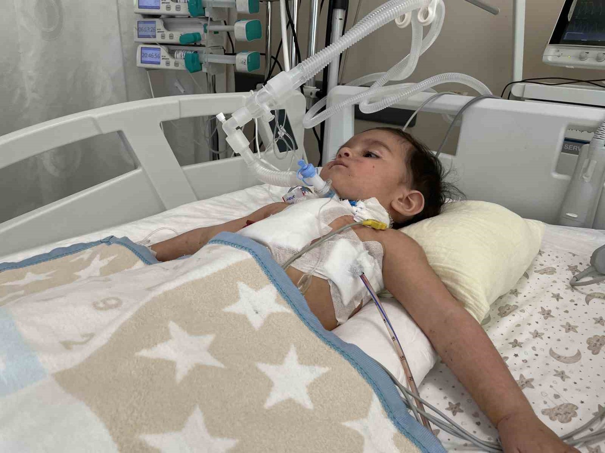Konya'da ECMO'ya bağlanan 1 yaşındaki bebeğin akciğerinden ceviz çıkarıldı