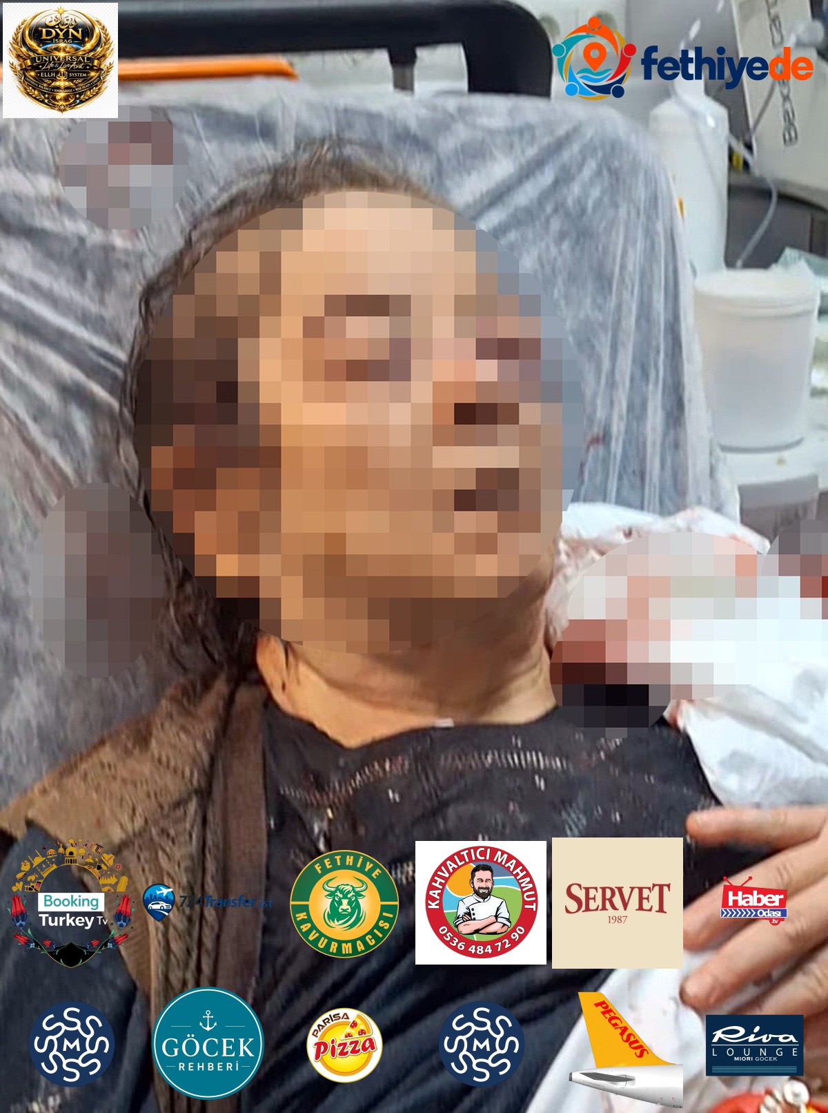 Kayseri'de evinde otururken tavan sıvası üzerine çöktü! 75 yaşındaki kadının sol gözünde ciddi görme kaybı