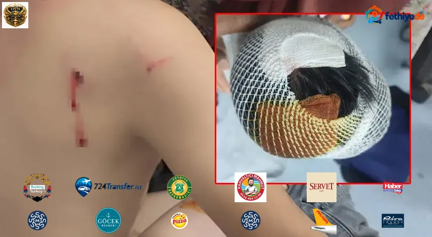 Başıboş köpek dehşeti! 8 yaşındaki çocuk hastanelik oldu