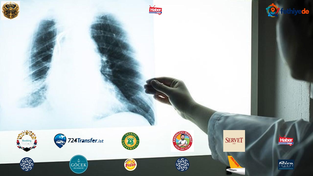 Akciğer kanserinde erken teşhisle yaşam şansı yüzde 90'ı aşıyor
