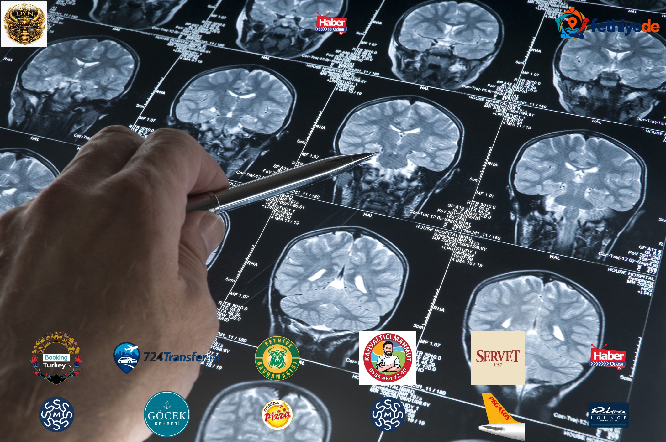 Alzheimer'da gençlik proteini keşfi