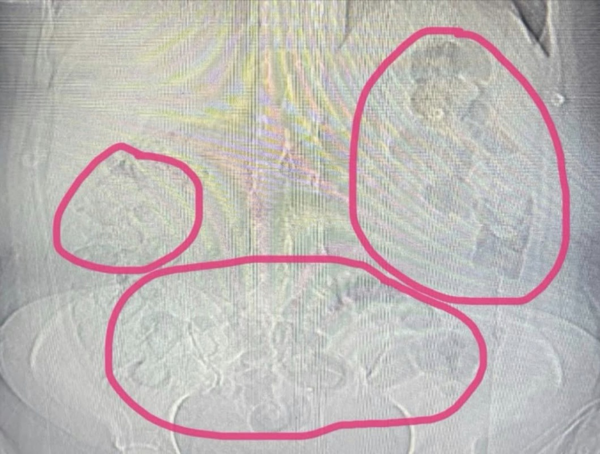 Sakarya'da 459 gram metamfetaminle yakalanan İran uyruklu şüpheli tutuklandı